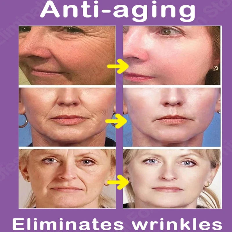 Hyaluronic Acid Wrinkle Removal Essence Niacinamide Whitening Brightening Moisturizing and Blemishes 5-in-1 Facial Care Essence